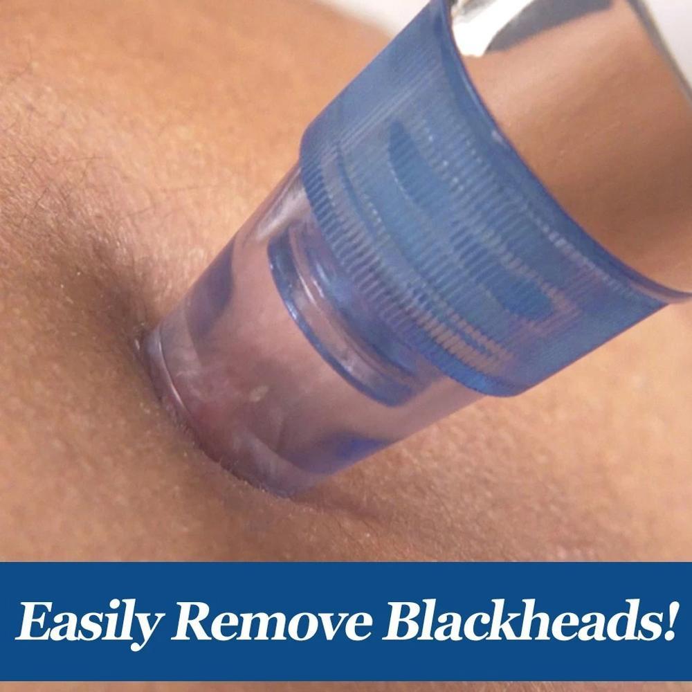 4 In 1 Blackhead Whitehead Extractor Remover Device Acne Pimple Pore Cleaner (Vacuum Suction Tool) thumbnail 5